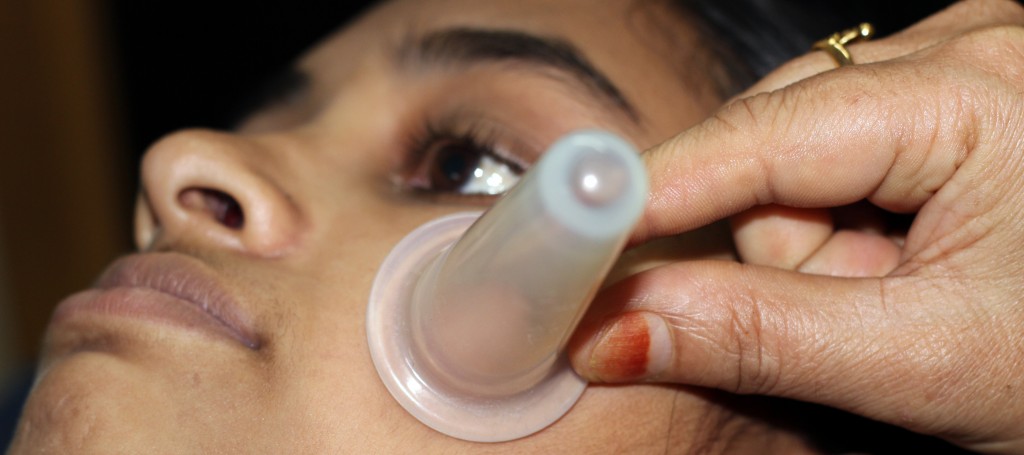 Facial Cupping